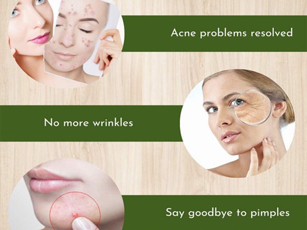 White Turmeric Powder - For Face, Kasturimanjal Powder, Kasturi Turmeric Powder, Body Pack, Turmeric Face Pack, Best for Acne, Pimples| OGOC